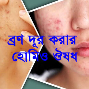 ব্রণ দূর করার হোমিও ঔষধ